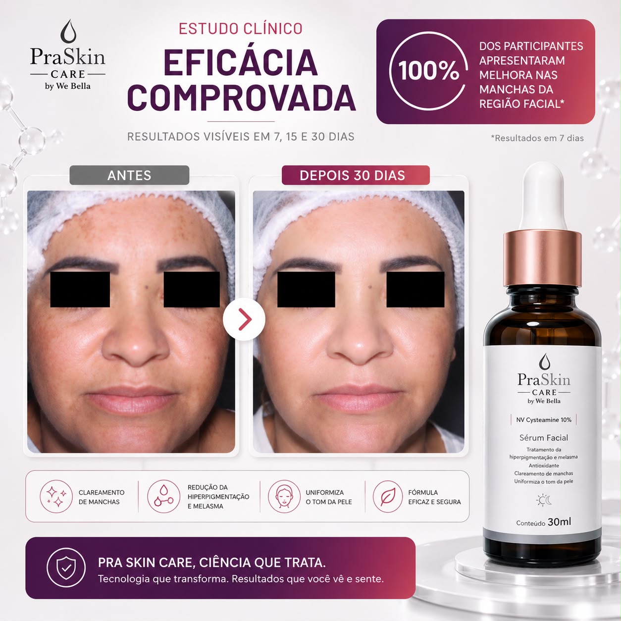 Sérum Facial Clareador Nv Cysteamine PraSkin Care by We Bella 30ml